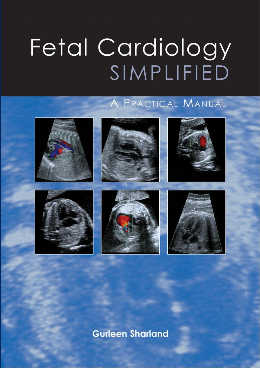 Big bigCover of Fetal Cardiology Simplified