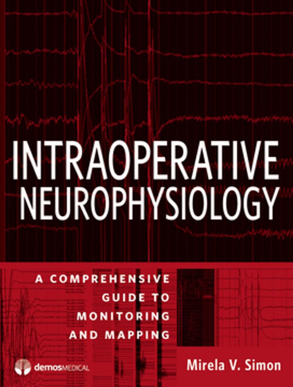 Big bigCover of Intraoperative Neurophysiology