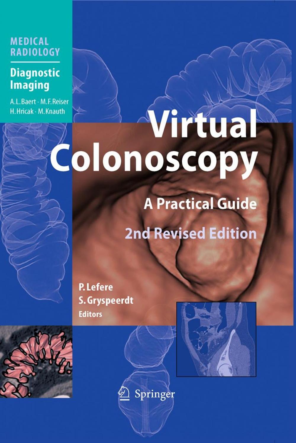 Big bigCover of Virtual Colonoscopy