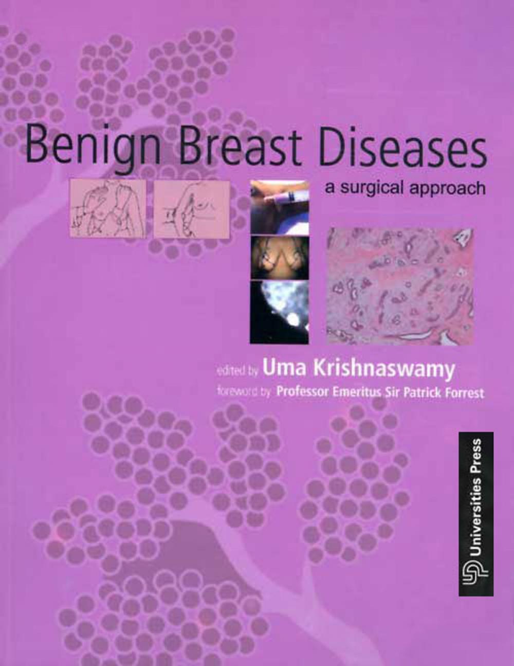 Big bigCover of Benign Breast Diseases