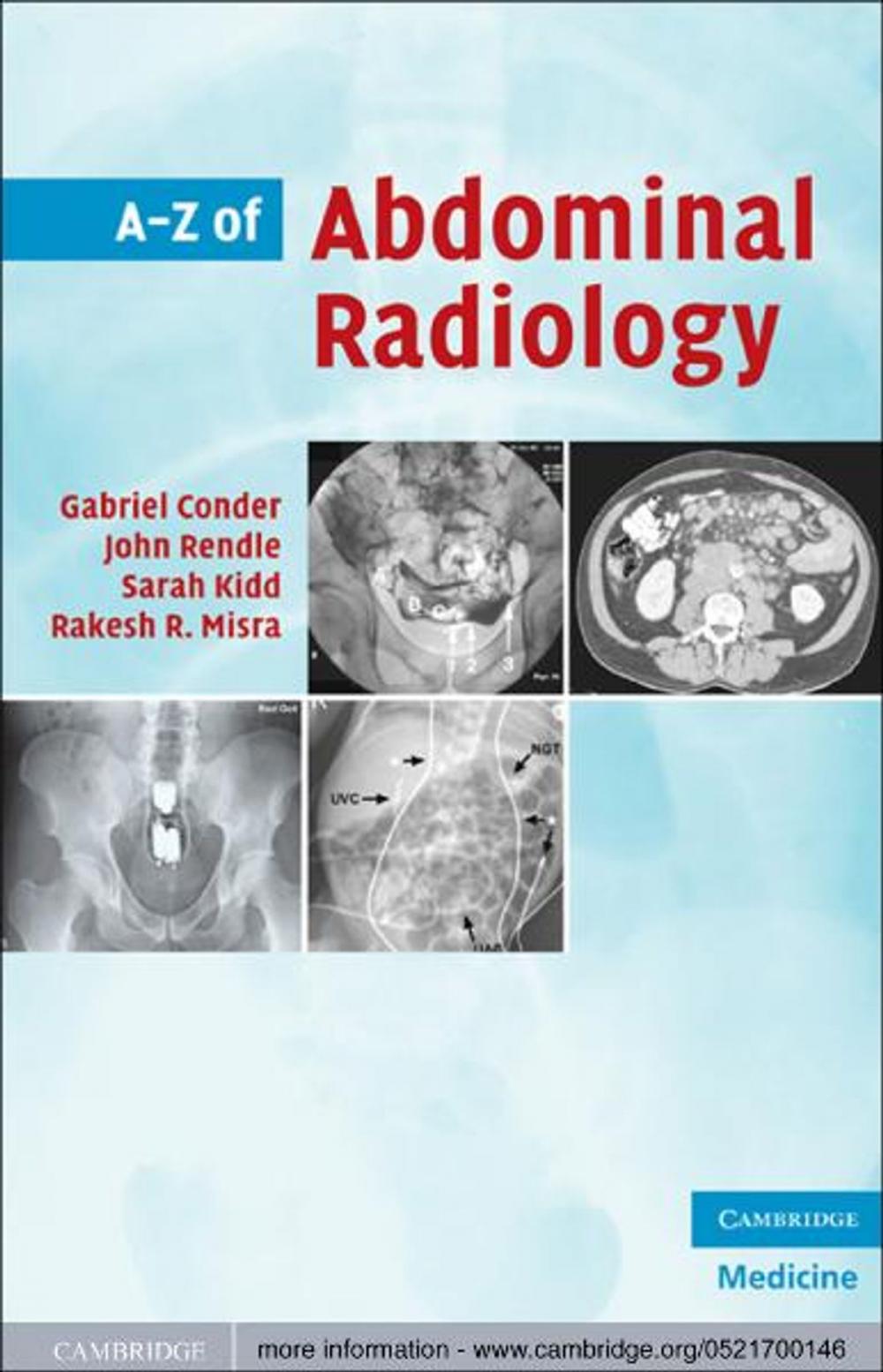 Big bigCover of A-Z of Abdominal Radiology