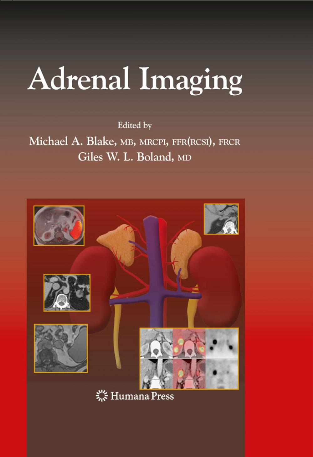 Big bigCover of Adrenal Imaging