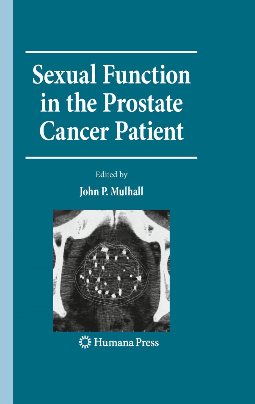 Big bigCover of Sexual Function in the Prostate Cancer Patient