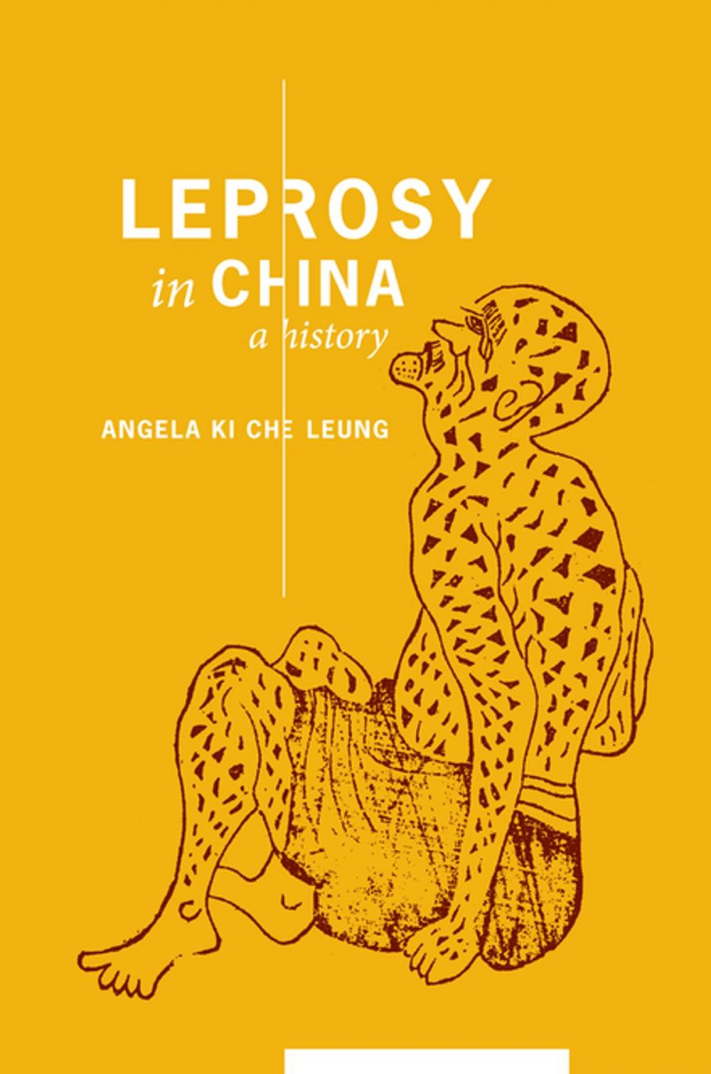 Big bigCover of Leprosy in China