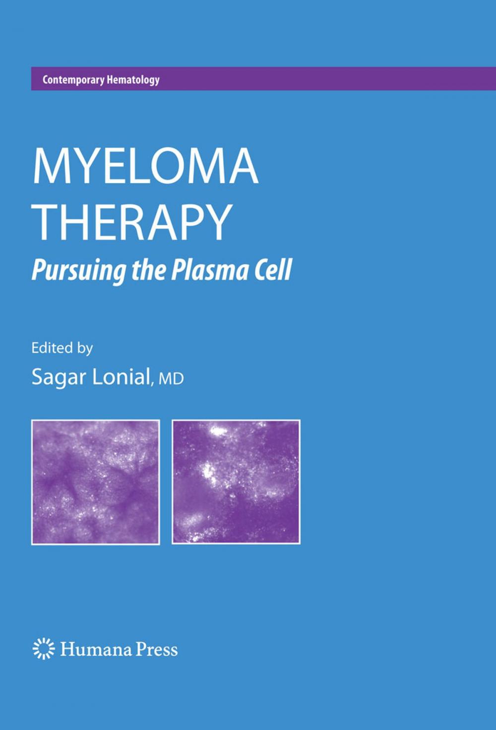 Big bigCover of Myeloma Therapy