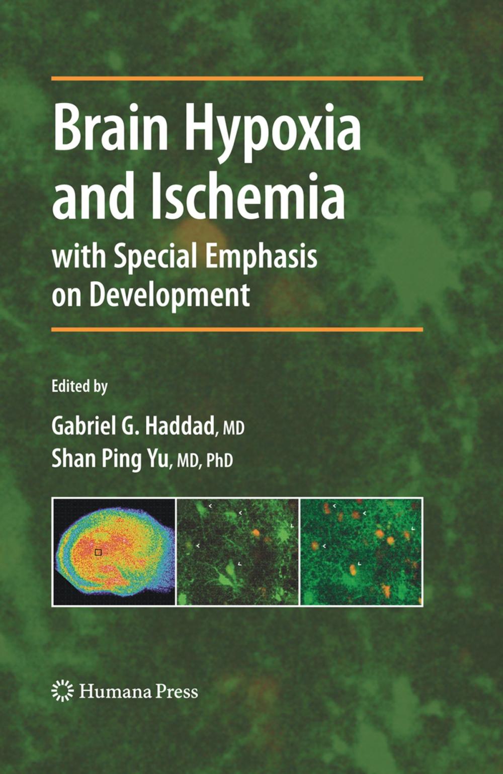 Big bigCover of Brain Hypoxia and Ischemia