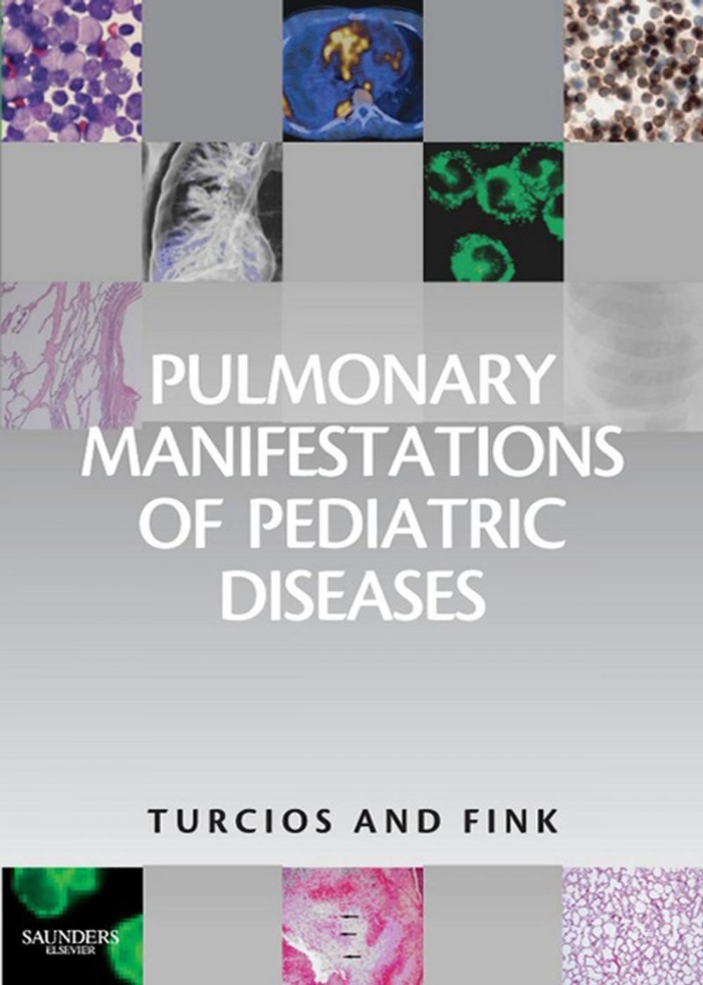 Big bigCover of Pulmonary Manifestations of Pediatric Diseases E-Book