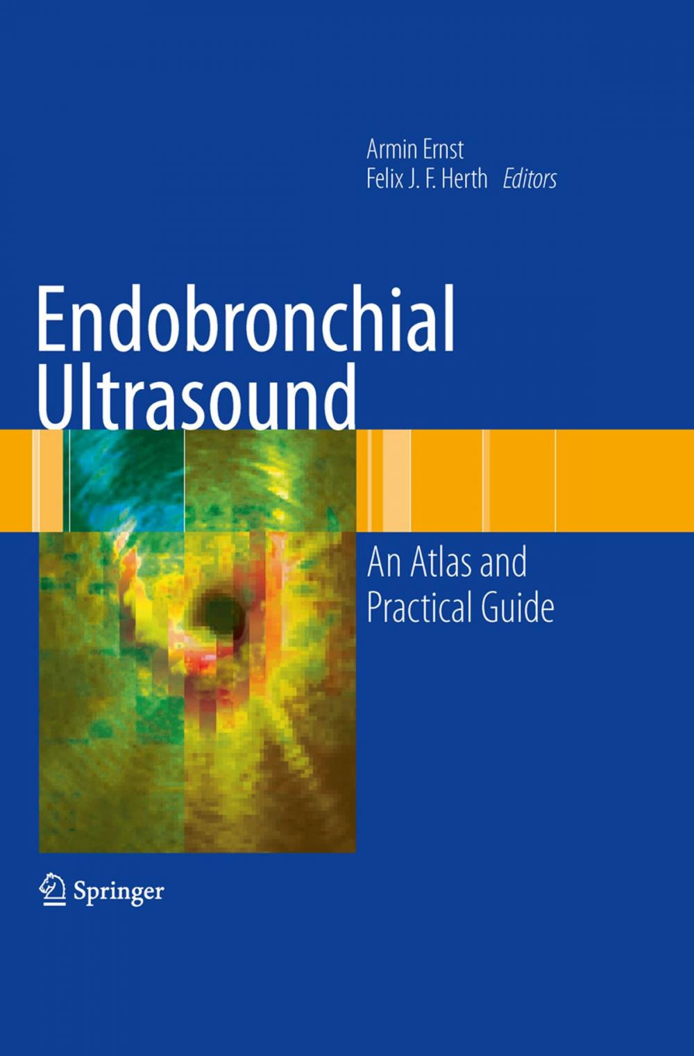 Big bigCover of Endobronchial Ultrasound