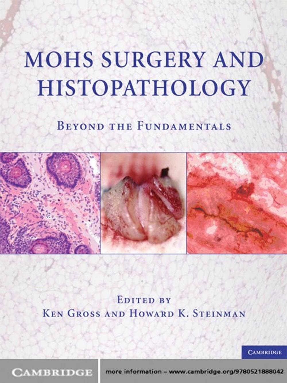 Big bigCover of Mohs Surgery and Histopathology