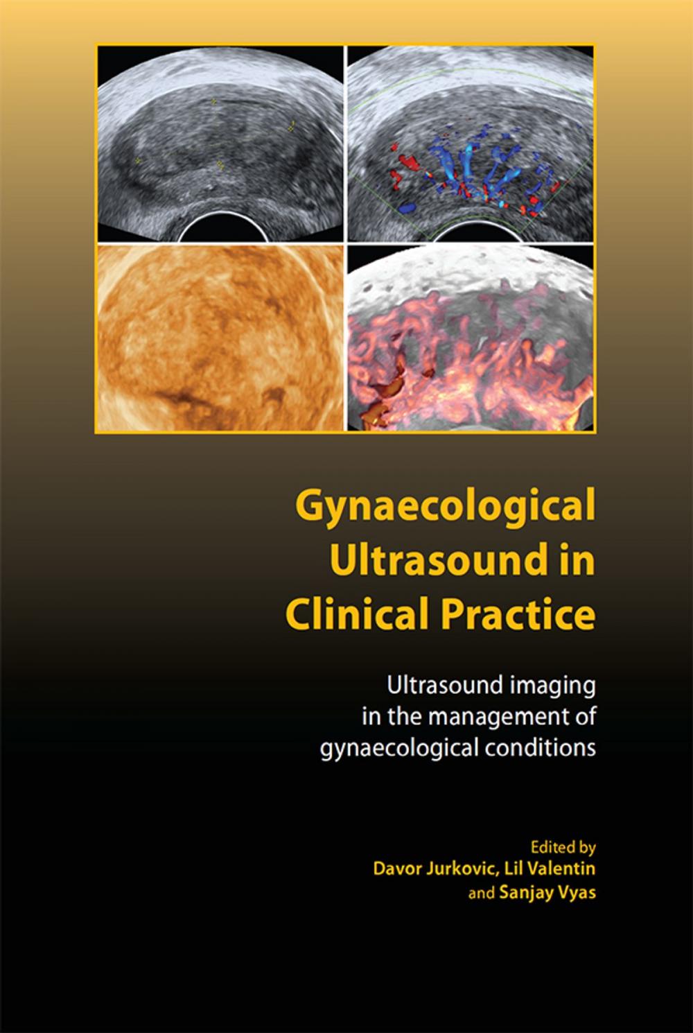 Big bigCover of Gynaecological Ultrasound in Clinical Practice