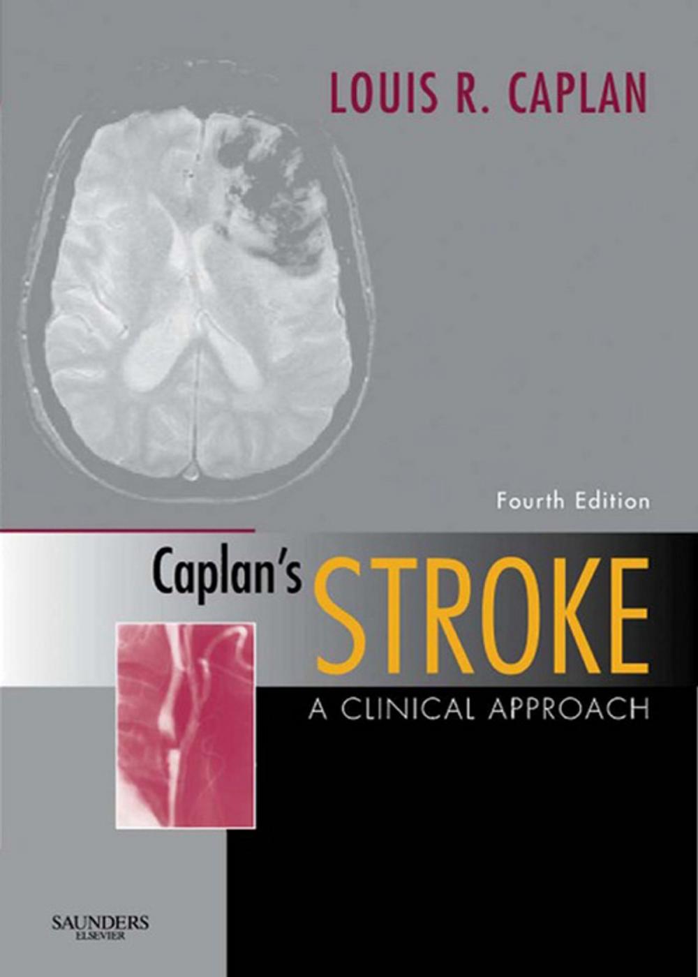 Big bigCover of Caplan's Stroke E-Book