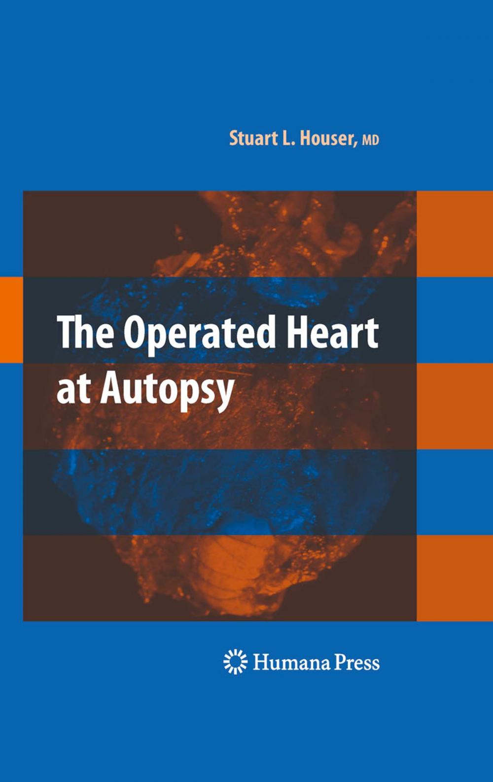 Big bigCover of The Operated Heart at Autopsy