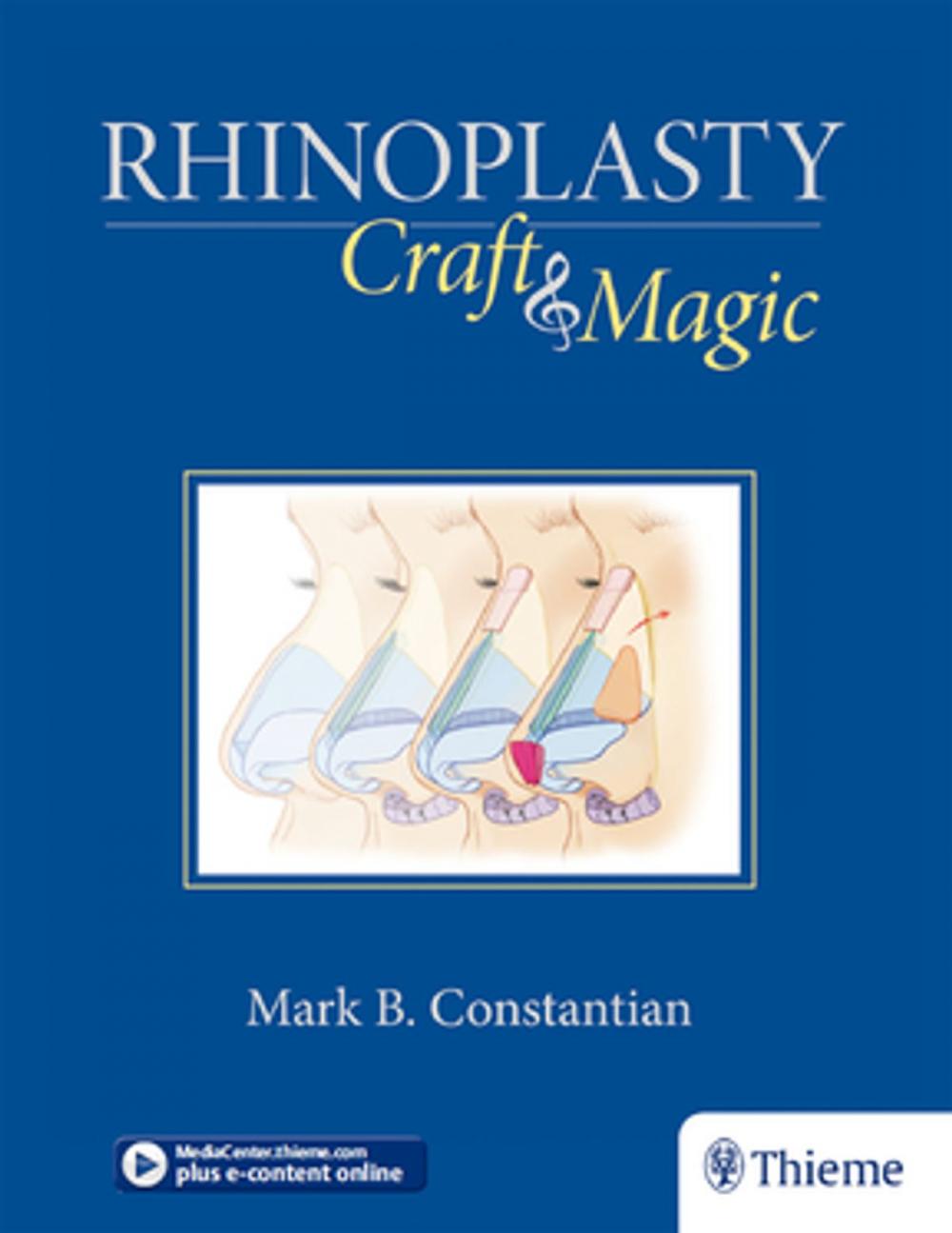 Big bigCover of Rhinoplasty