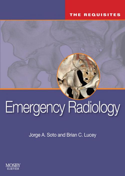 Cover of the book Emergency Radiology: The Requisites E-Book by Jorge A Soto, MD, Brian C Lucey, MD, Elsevier Health Sciences