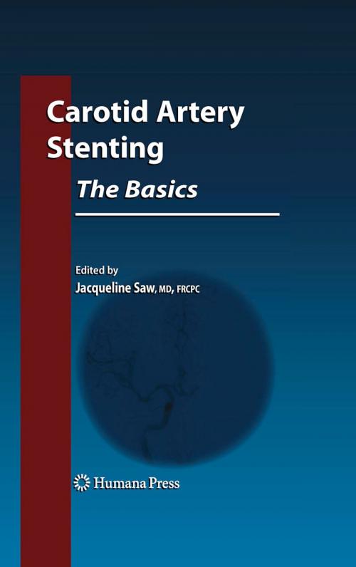 Cover of the book Carotid Artery Stenting: The Basics by , Humana Press