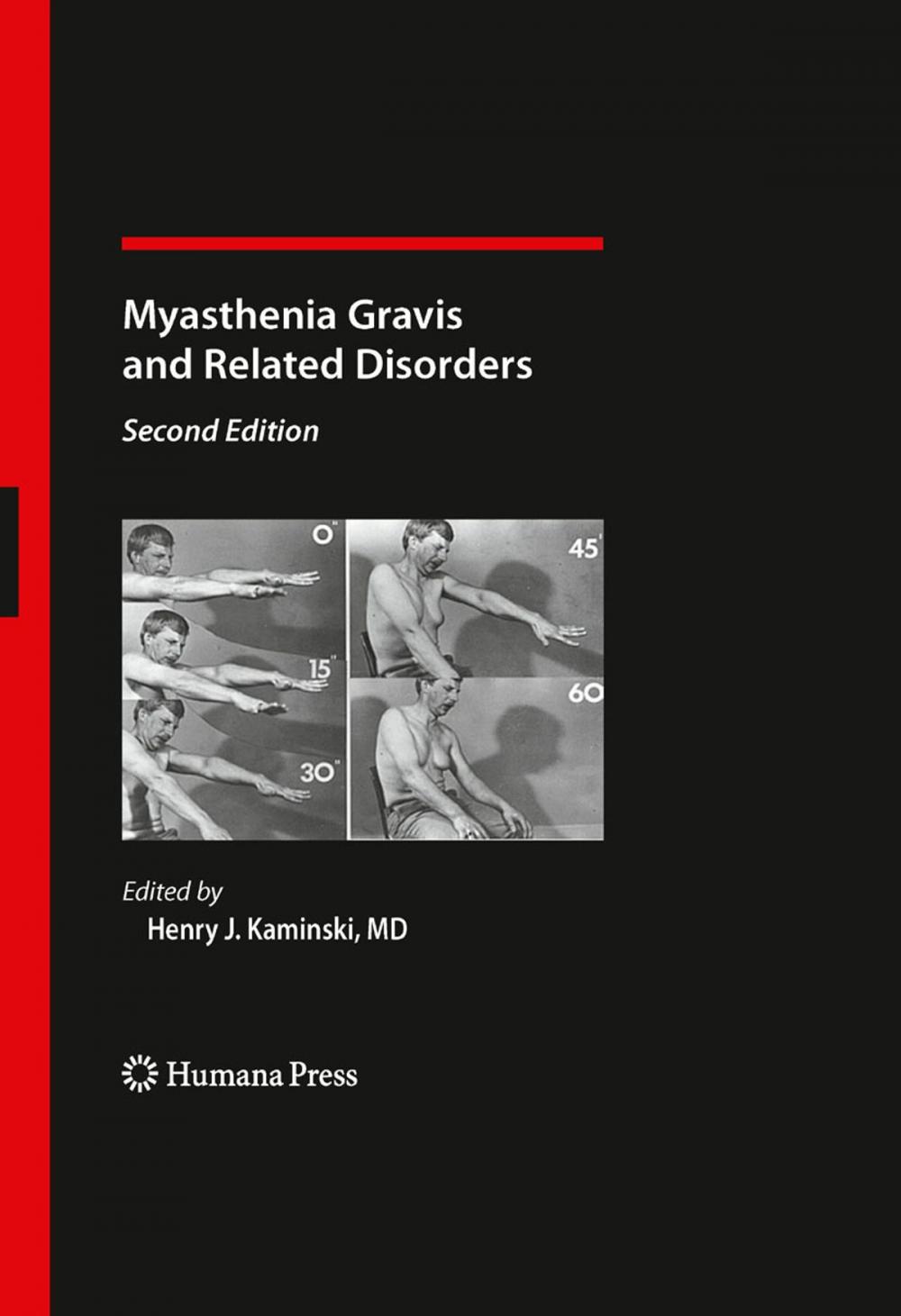 Big bigCover of Myasthenia Gravis and Related Disorders