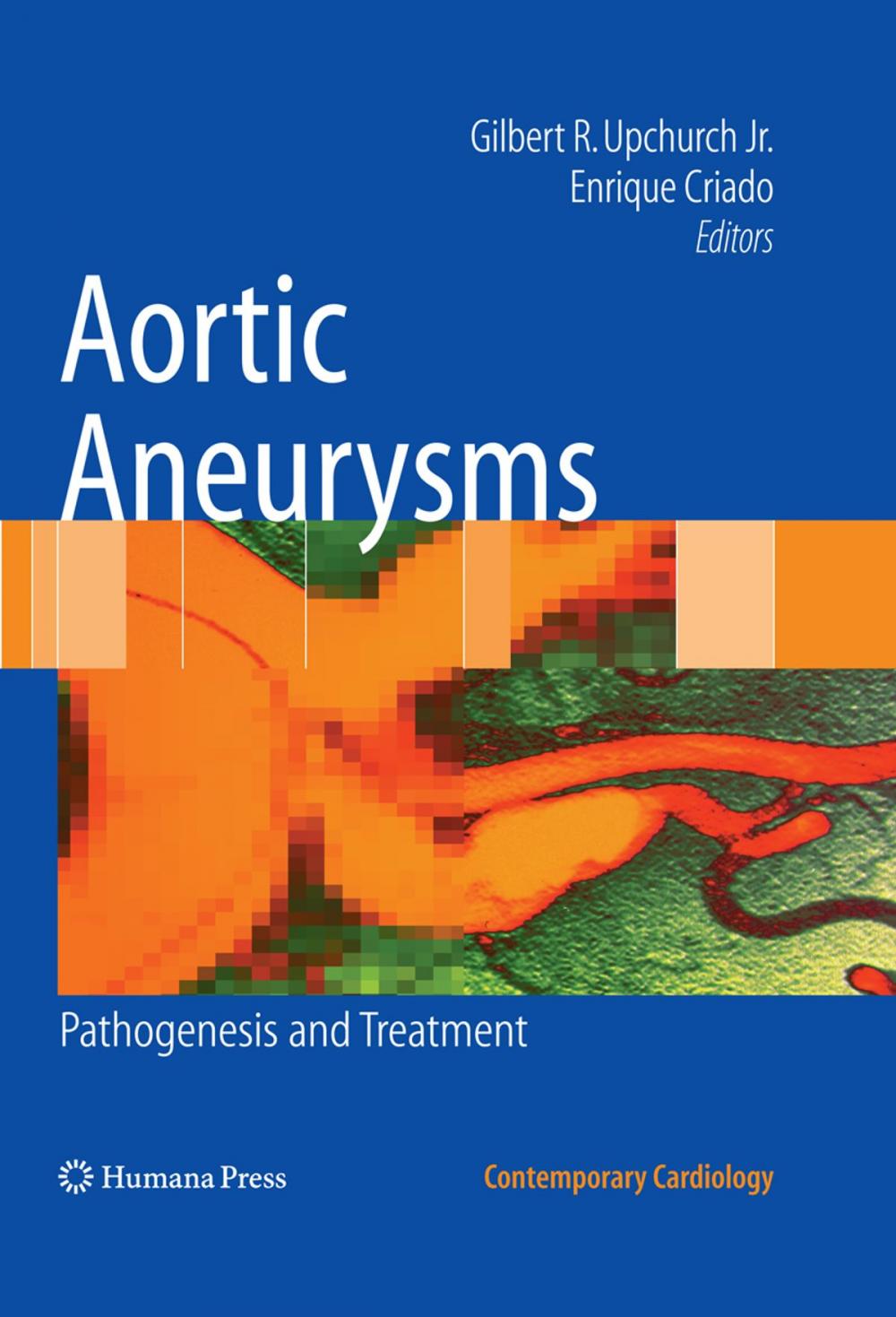 Big bigCover of Aortic Aneurysms