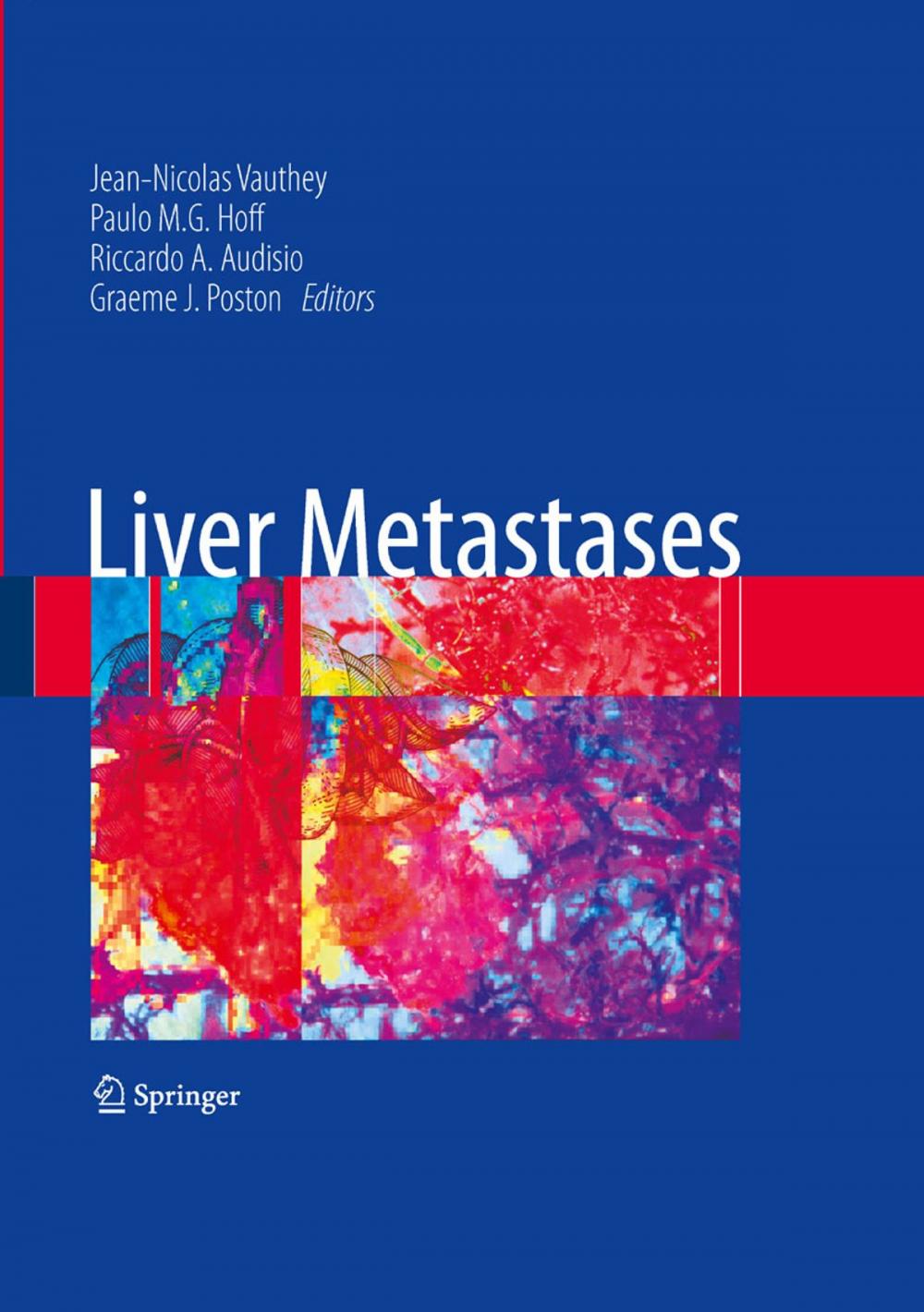 Big bigCover of Liver Metastases