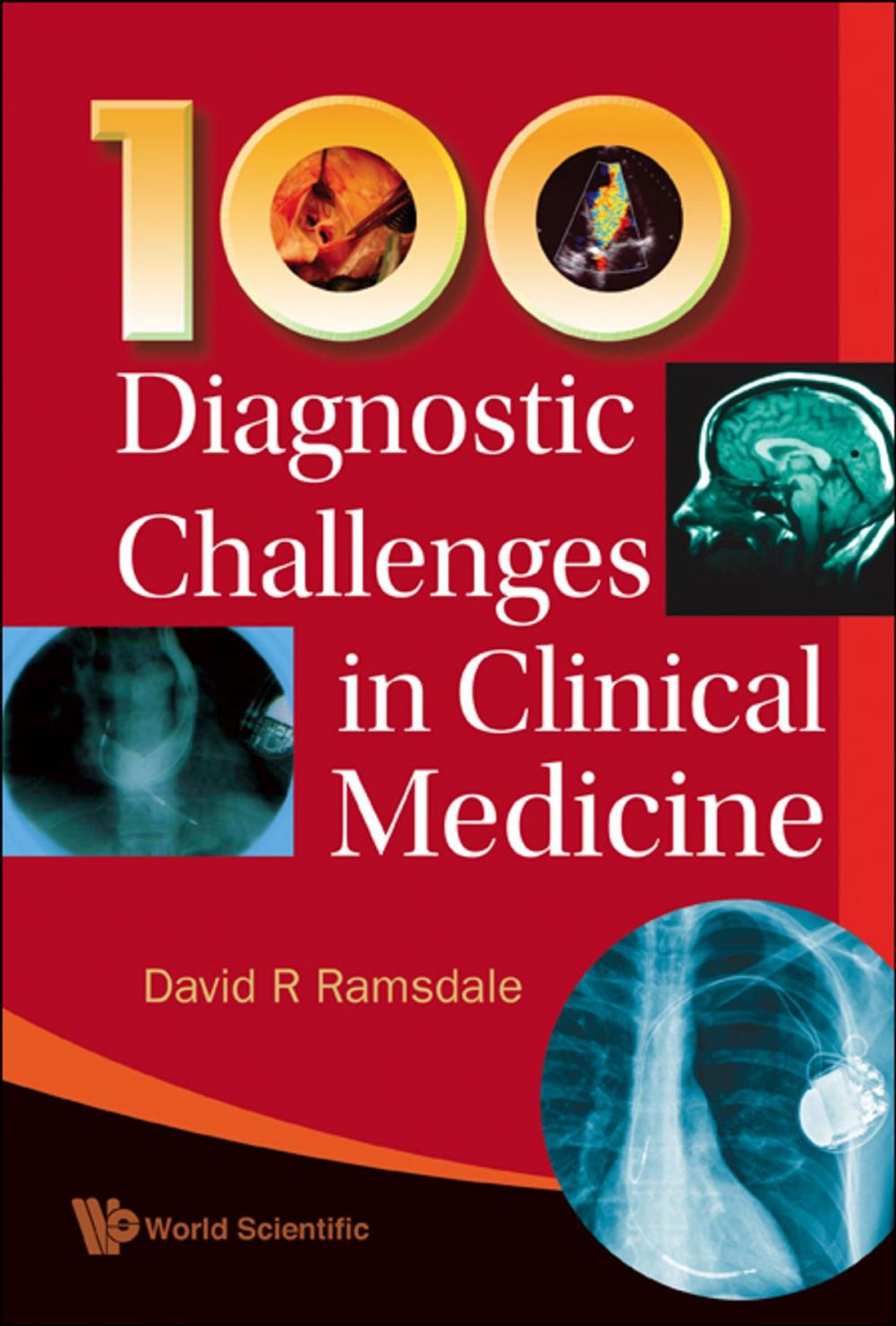 Big bigCover of 100 Diagnostic Challenges in Clinical Medicine