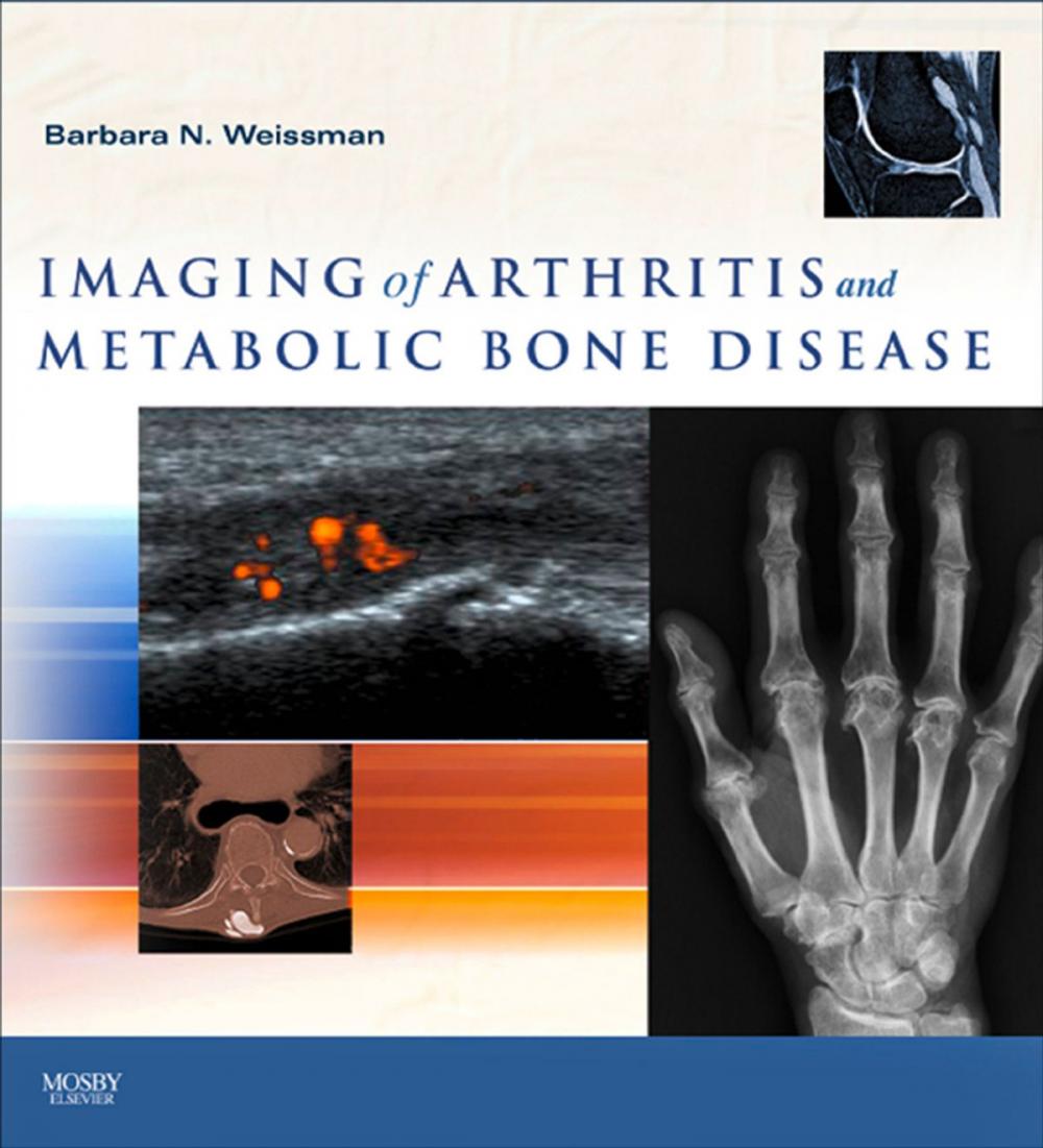 Big bigCover of Imaging of Arthritis and Metabolic Bone Disease E-Book