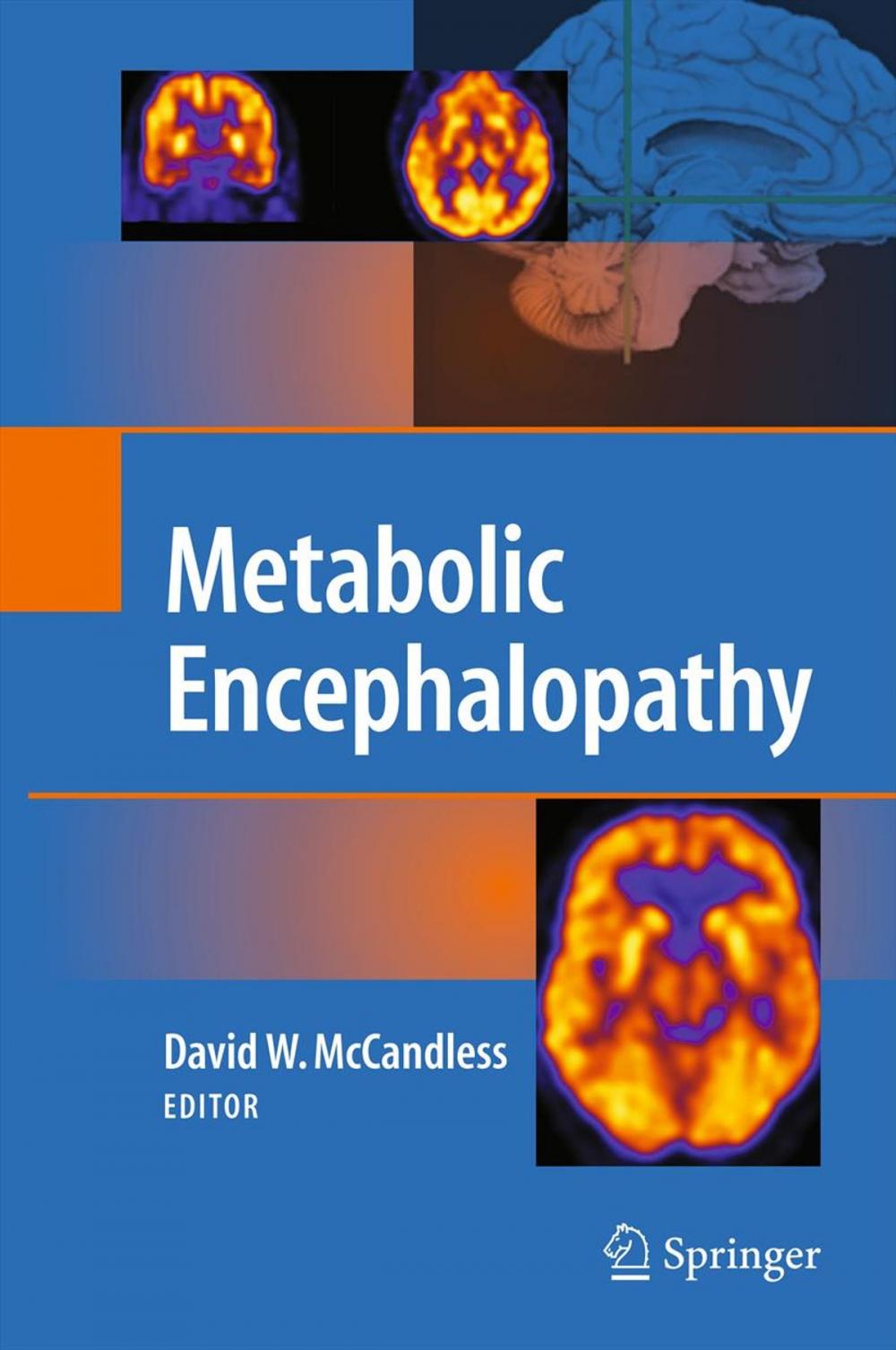 Big bigCover of Metabolic Encephalopathy