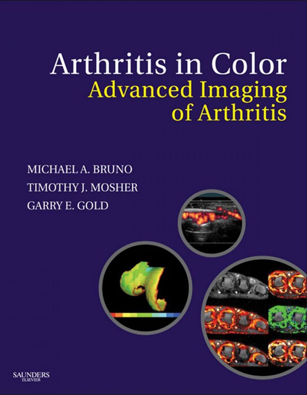 Big bigCover of Arthritis in Color E-Book