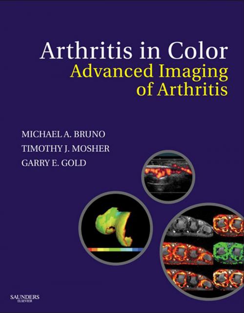 Cover of the book Arthritis in Color E-Book by Michael A. Bruno, MD, Gary E. Gold, Timothy J. Mosher, Elsevier Health Sciences