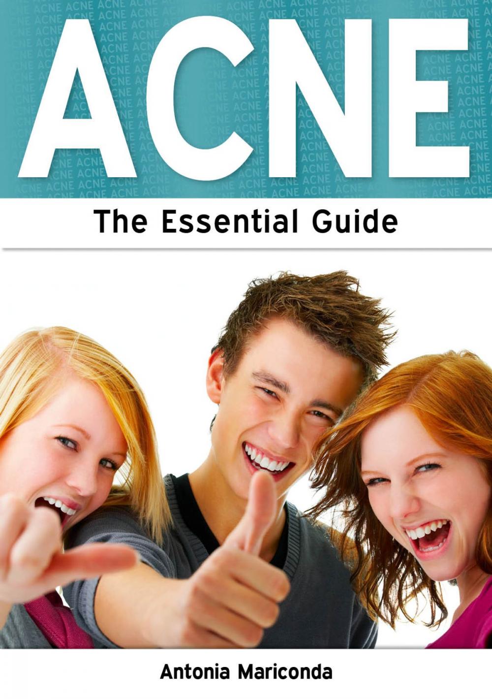 Big bigCover of Acne: The Essential Guide
