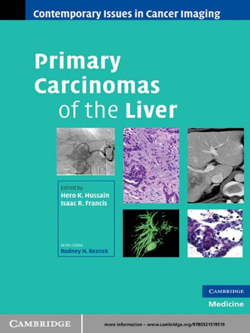 Big bigCover of Primary Carcinomas of the Liver
