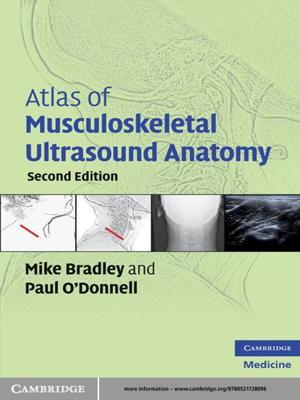 Big bigCover of Atlas of Musculoskeletal Ultrasound Anatomy