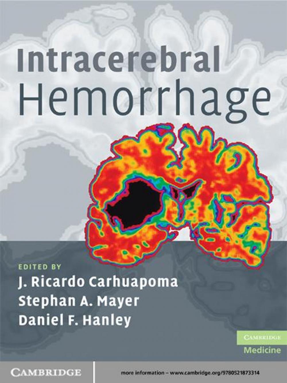 Big bigCover of Intracerebral Hemorrhage