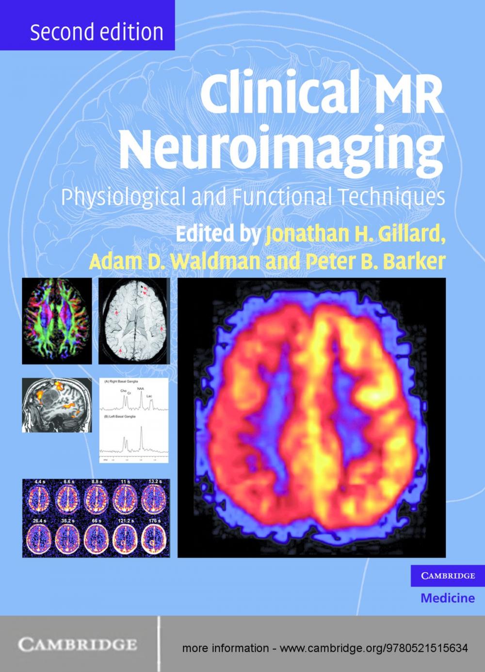 Big bigCover of Clinical MR Neuroimaging