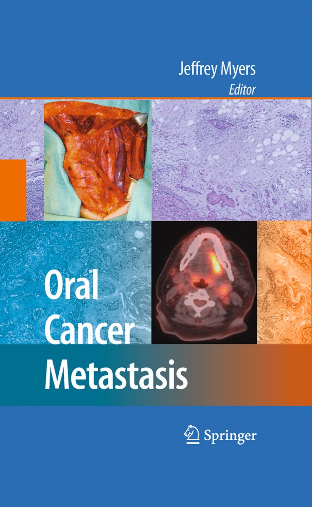 Big bigCover of Oral Cancer Metastasis