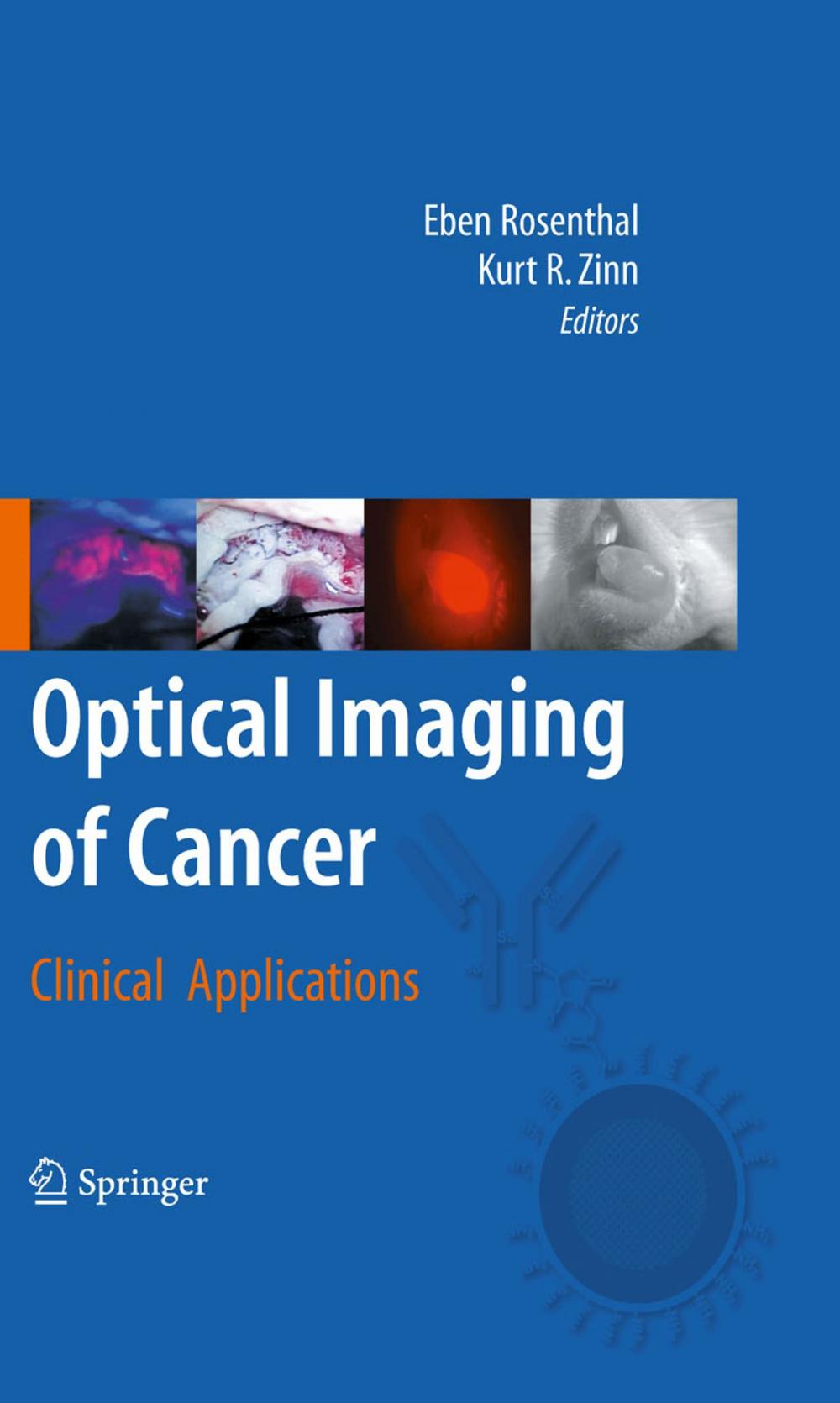 Big bigCover of Optical Imaging of Cancer