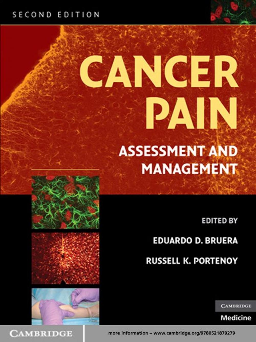 Big bigCover of Cancer Pain