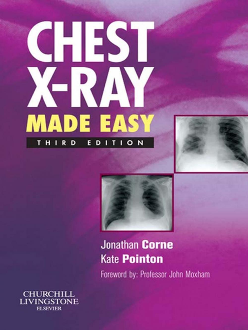 Big bigCover of Chest X-Ray Made Easy E-Book