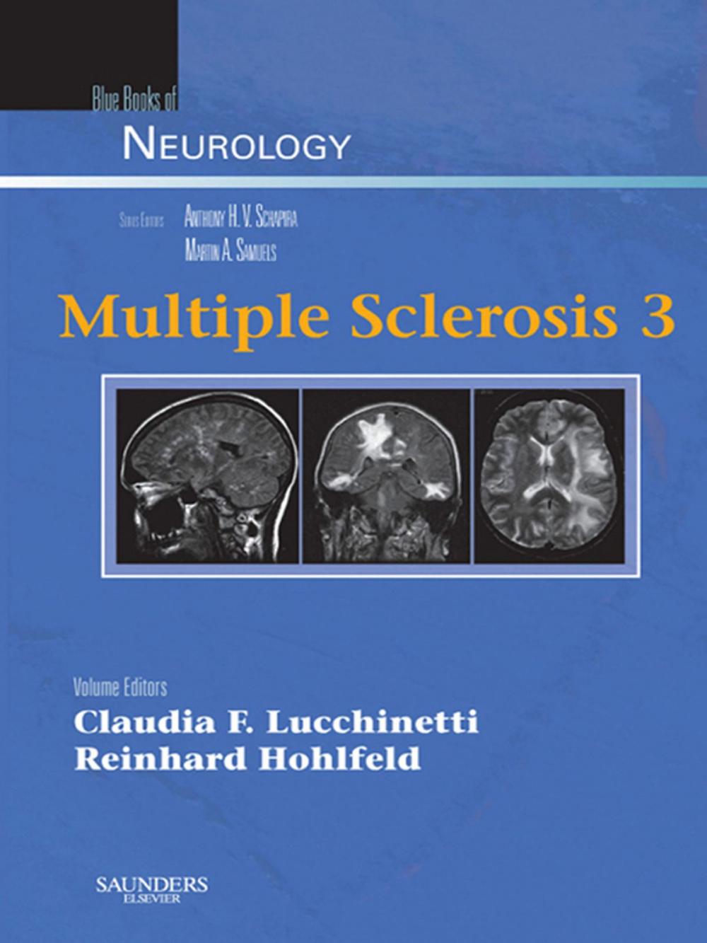 Big bigCover of Multiple Sclerosis 3, Volume 34 E-Book