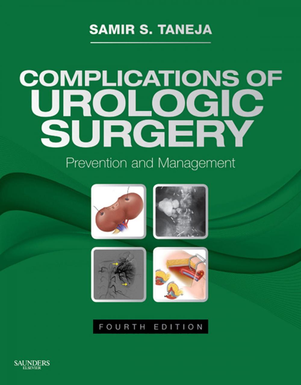 Big bigCover of Complications of Urologic Surgery E-Book