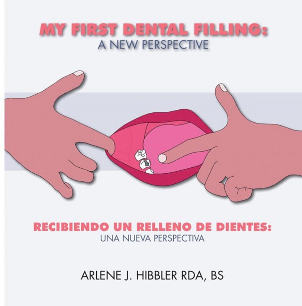 Big bigCover of My First Dental Filling: a New Perspective