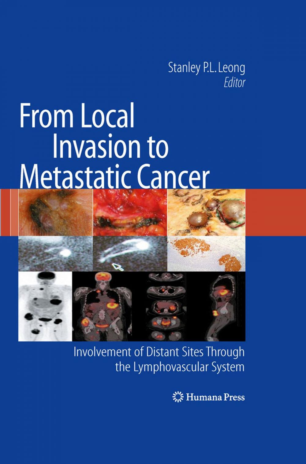 Big bigCover of From Local Invasion to Metastatic Cancer