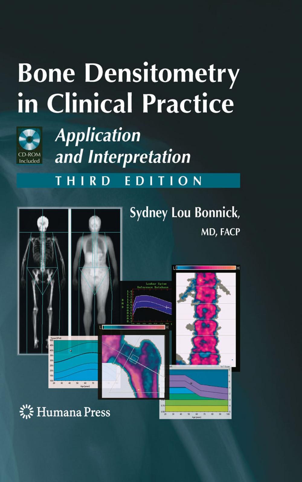 Big bigCover of Bone Densitometry in Clinical Practice