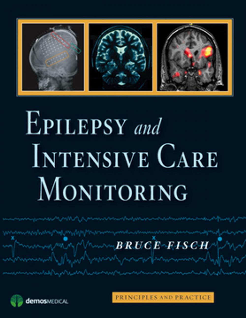 Big bigCover of Epilepsy and Intensive Care Monitoring