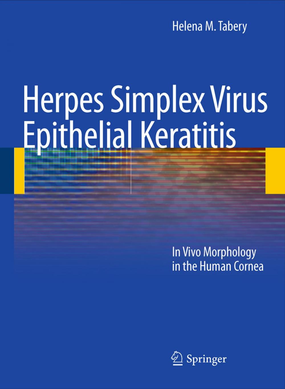 Big bigCover of Herpes Simplex Virus Epithelial Keratitis
