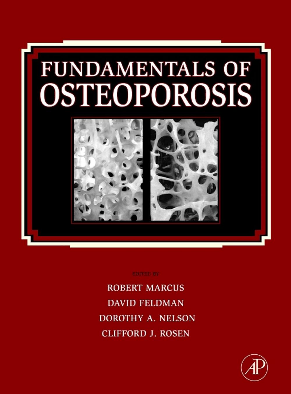 Big bigCover of Fundamentals of Osteoporosis