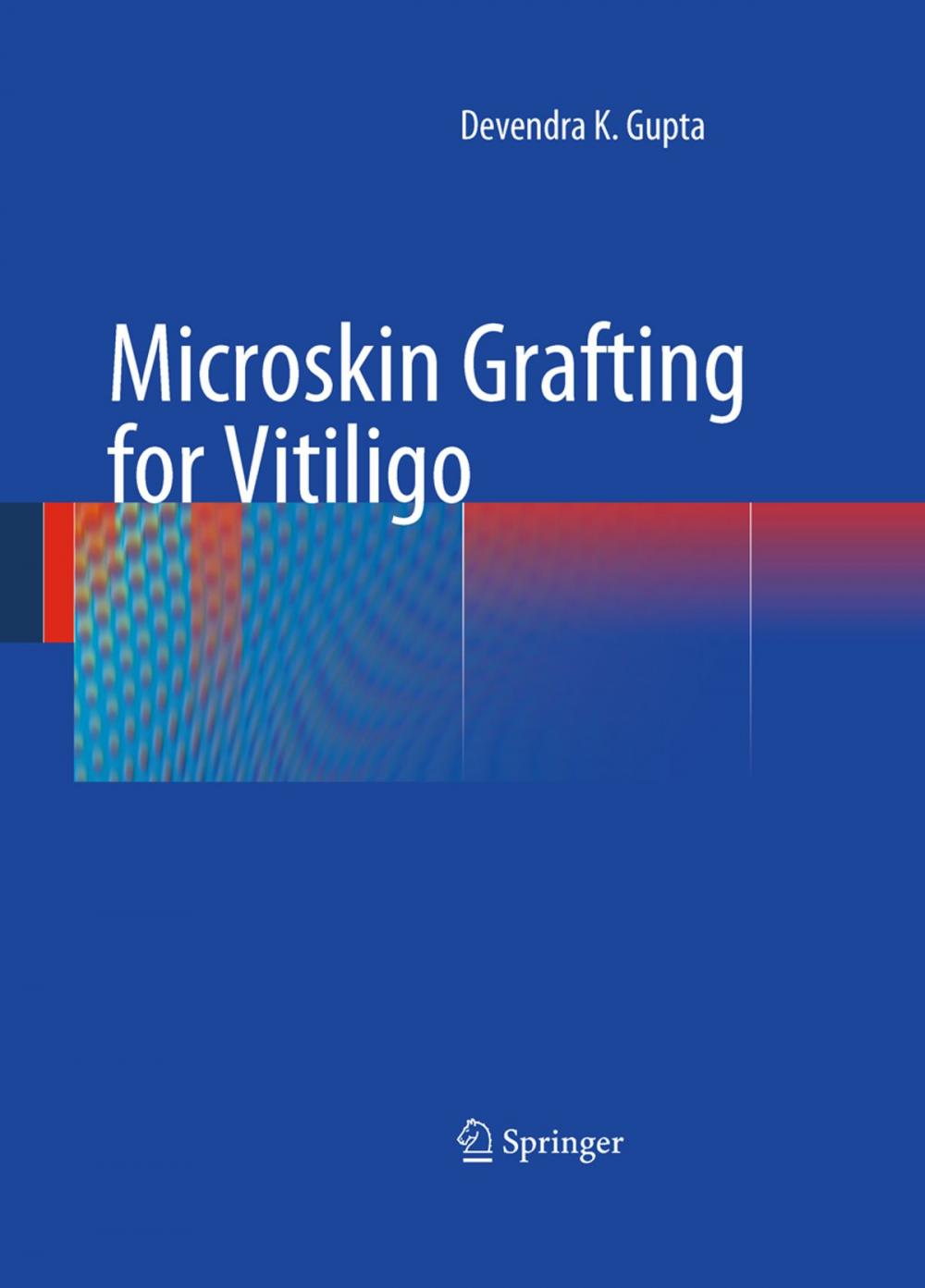 Big bigCover of Microskin Grafting for Vitiligo