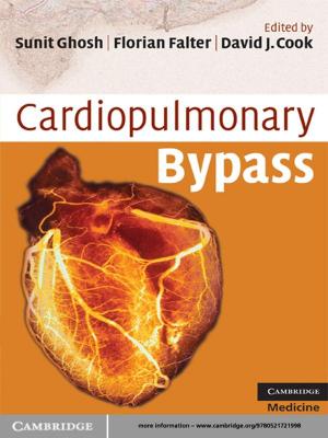 Cover of the book Cardiopulmonary Bypass by Mircea Sofonea, Andaluzia Matei
