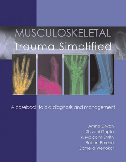 Cover of the book Musculoskeletal Trauma Simplified by Shivani Gupta, Amna Diwan, Richard W Perone, R Malcolm Smith, Cornelia Wenokor, tfm Publishing Ltd