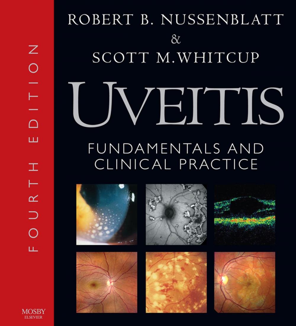 Big bigCover of Uveitis E-Book