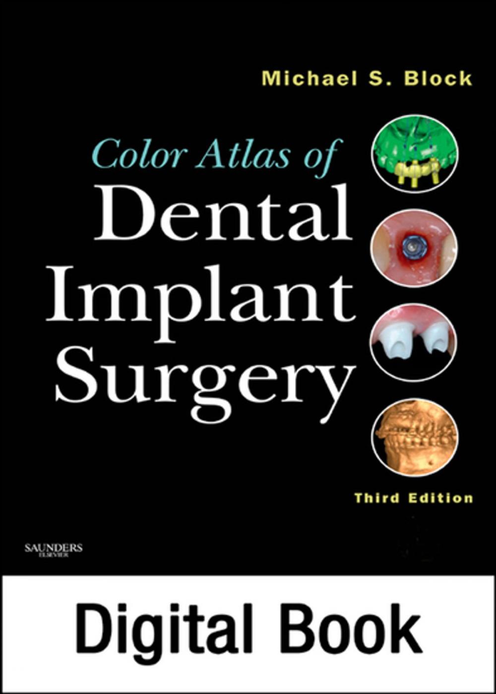 Big bigCover of Color Atlas of Dental Implant Surgery - E-Book