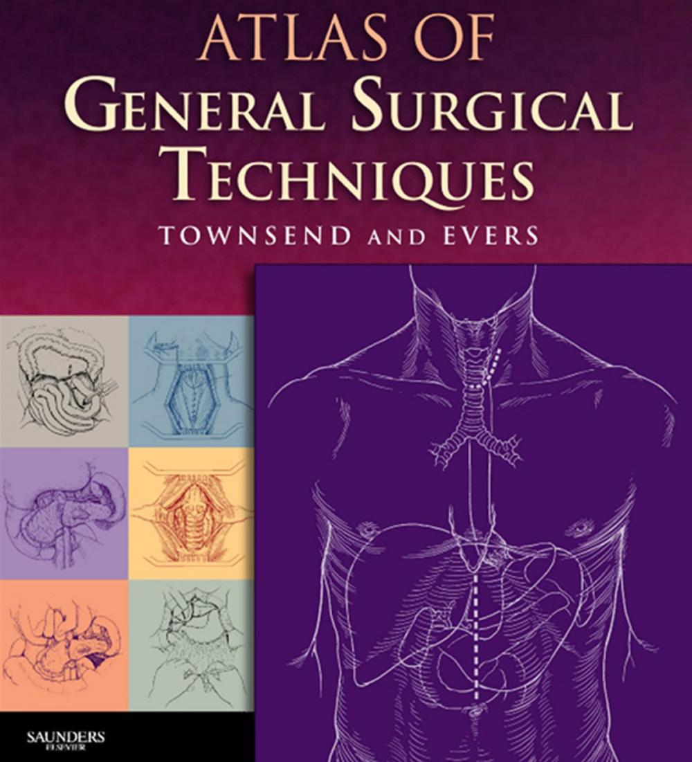 Big bigCover of Atlas of General Surgical Techniques E-Book